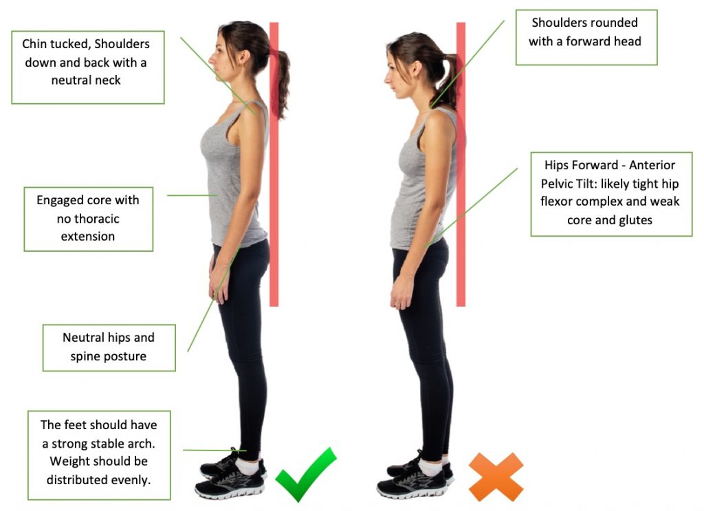 5 Reasons You Should Work On Your Body Posture